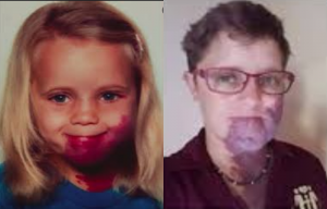 Les Taches De Naissance Transformation Etonnantes Des Brutes L Appelaient Mangeuse De Pourpres Letopfrance